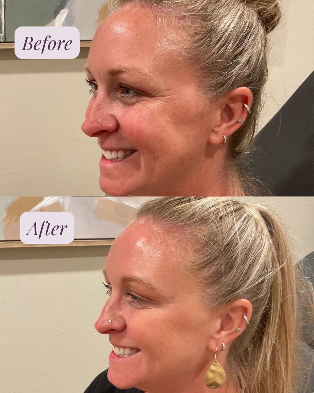 Instagram post from kiara_medspa. This post is in position 3.