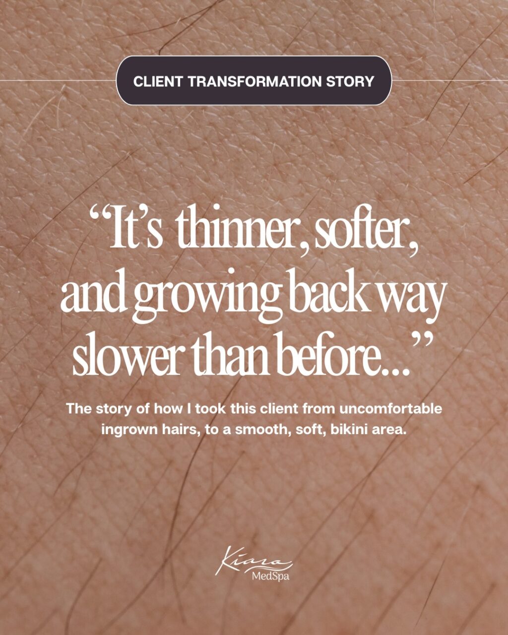 Instagram post from kiara_medspa. This post is in position 0.