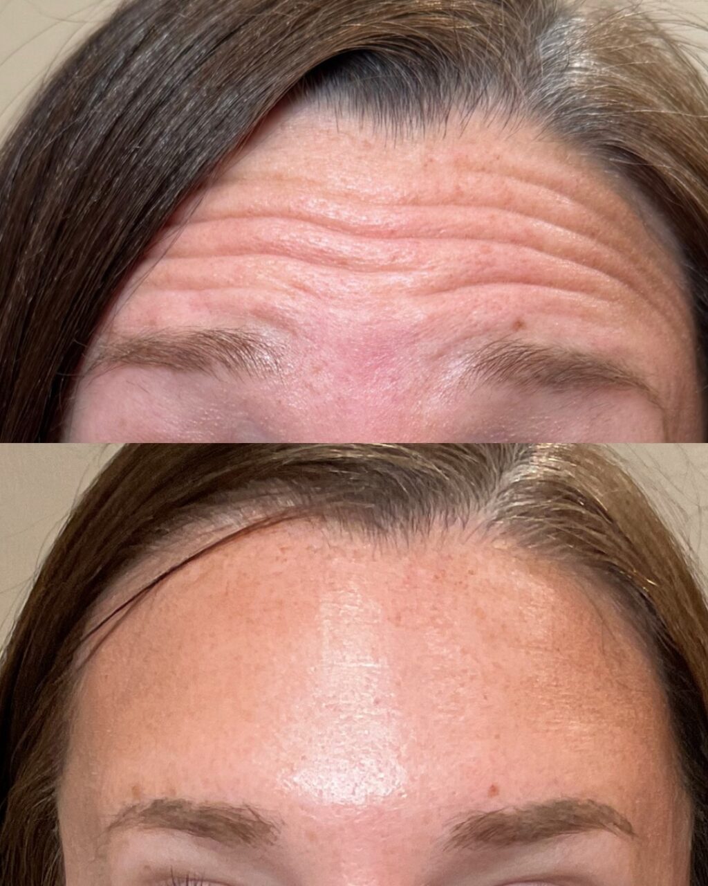 Instagram post from kiara_medspa. This post is in position 1.