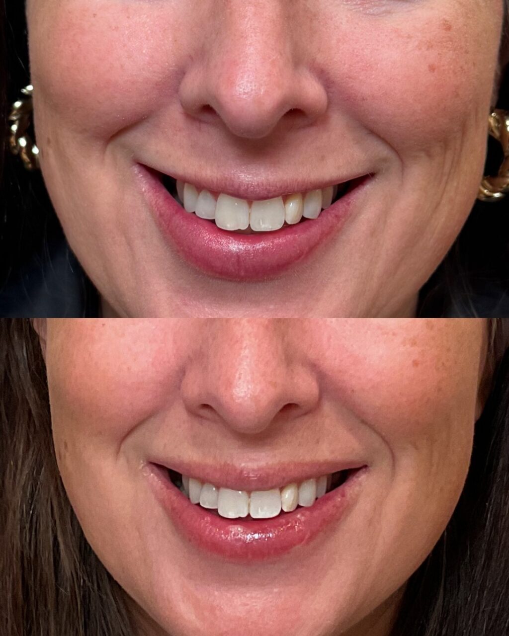 Instagram post from kiara_medspa. This post is in position 2.