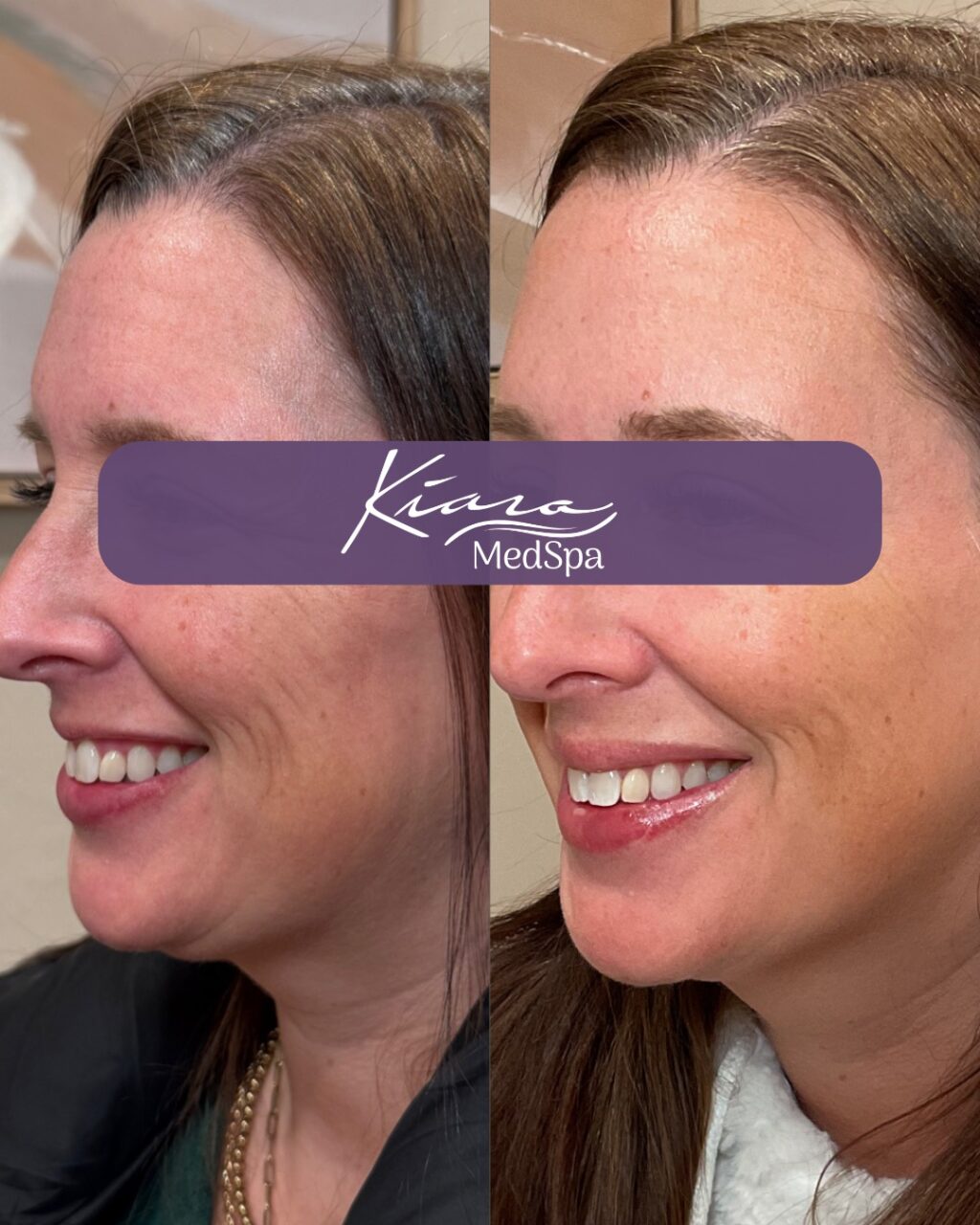 Instagram post from kiara_medspa. This post is in position 0.