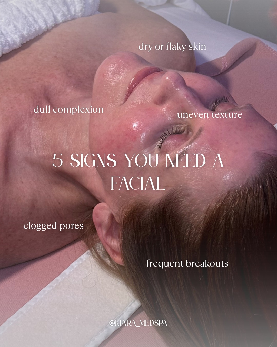 Instagram post from kiara_medspa. This post is in position 4.