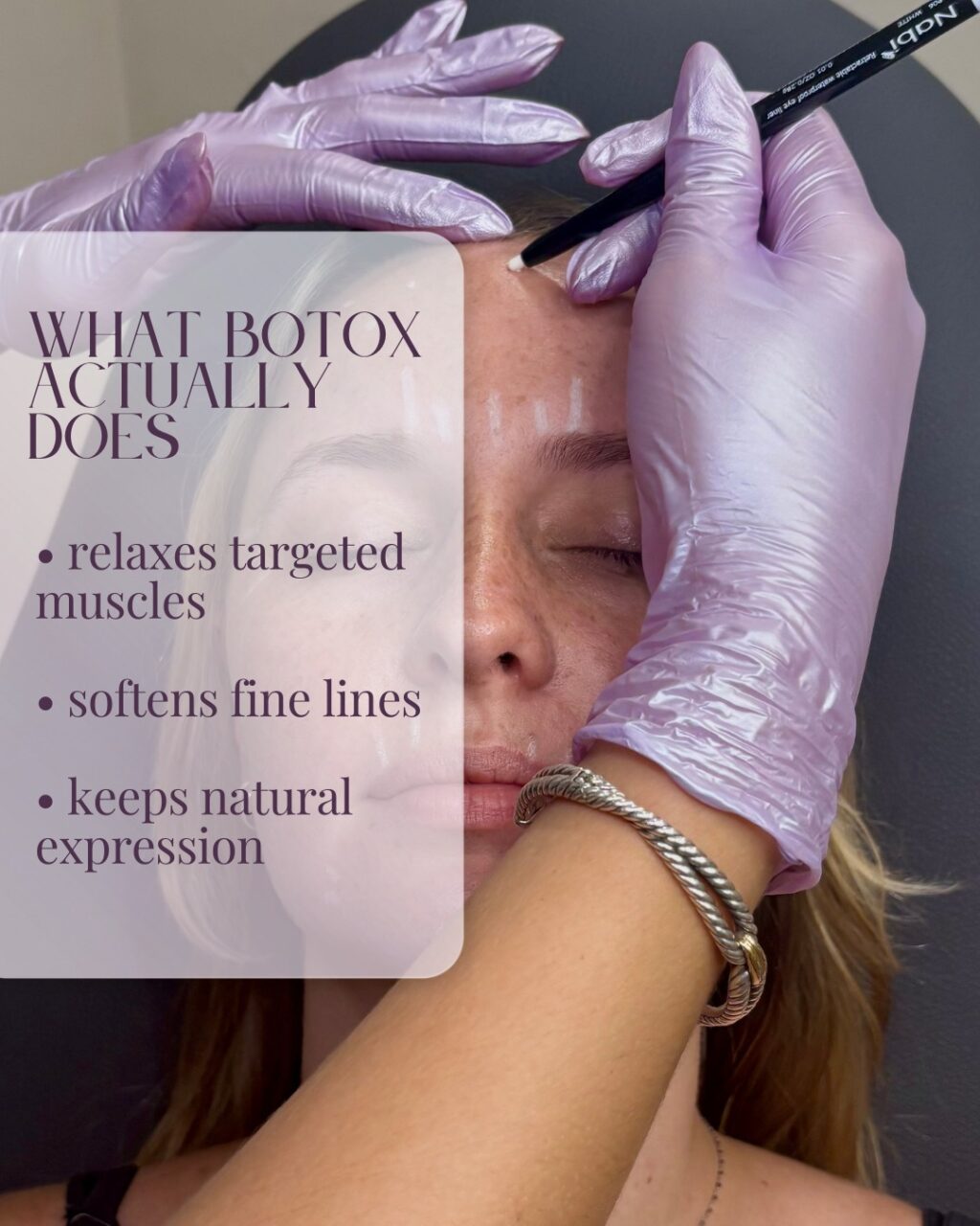 Instagram post from kiara_medspa. This post is in position 1.