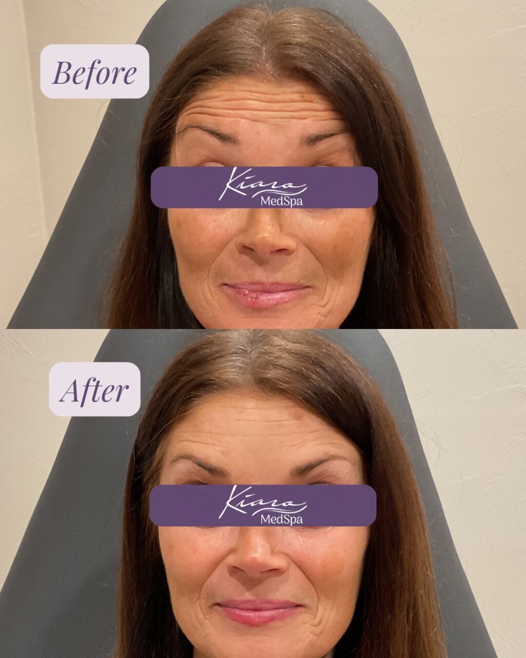 Instagram post from kiara_medspa. This post is in position 7.