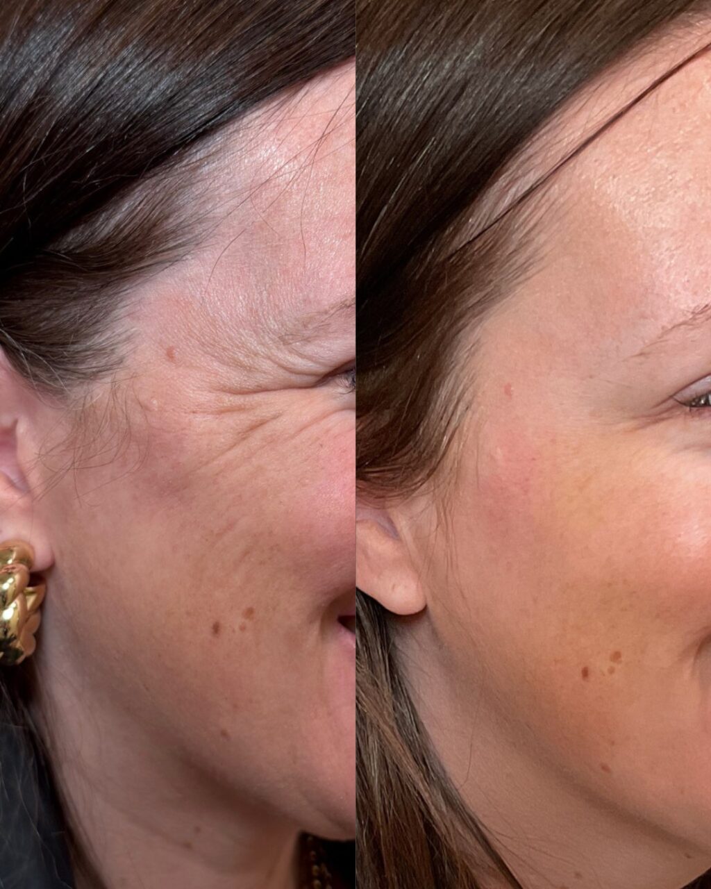 Instagram post from kiara_medspa. This post is in position 3.